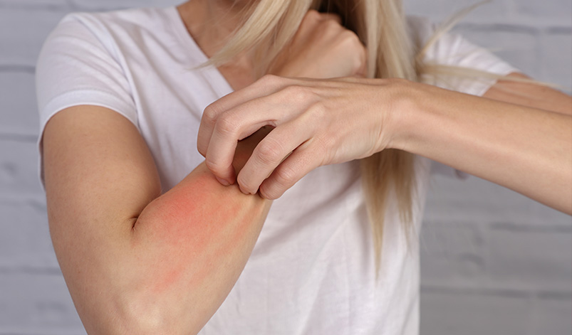 Combater a Alergia Alimentar