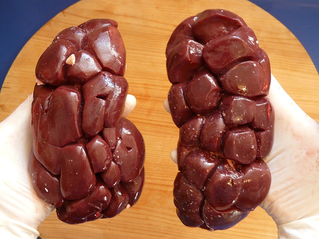 Pedra nos Rins