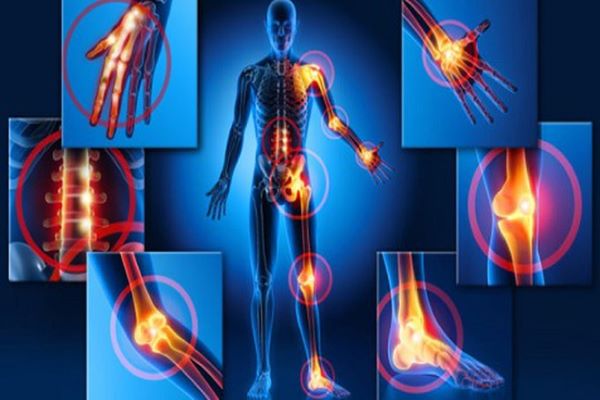 Tratar a Fibromialgia